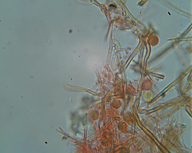 Asterostroma laxum Bres. (1920)